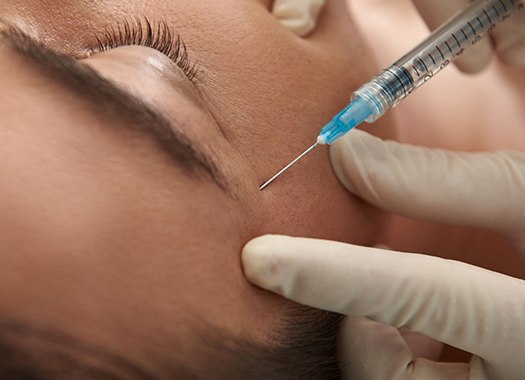 botox-2