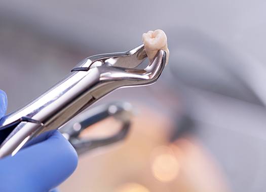 extractions-3