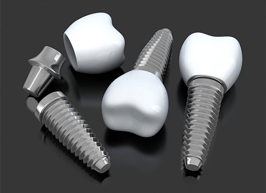 implants-merge-1