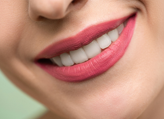 smile-makeover-1
